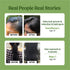 Vilvah Store Hair Growth Oil
